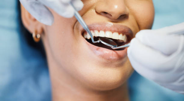 Best Emergency Denture Repair in Valley Stream, NY